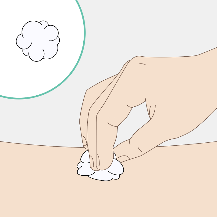Mit Wattebausch andrücken